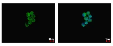 Anti-NCF1 antibody used in Immunocytochemistry/ Immunofluorescence (ICC/IF). GTX102957