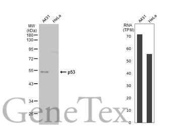 Anti-p53 antibody used in Western Blot (WB). GTX102965