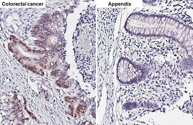 Anti-p53 antibody used in IHC (Paraffin sections) (IHC-P). GTX102965