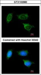 Anti-ATP synthase B1 antibody used in Immunocytochemistry/ Immunofluorescence (ICC/IF). GTX102980