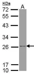 Anti-ATP synthase B1 antibody used in Western Blot (WB). GTX102980