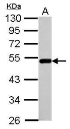 Anti-BLMH antibody [N1C1] used in Western Blot (WB). GTX102984