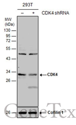 Anti-CDK4 antibody used in Western Blot (WB). GTX102993