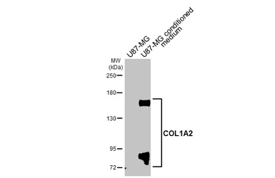 Anti-COL1A2 antibody [C2C3], C-term used in Western Blot (WB). GTX102996