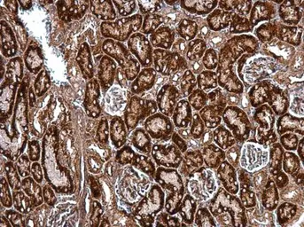 Anti-HSP47 antibody [N2C2], Internal used in IHC (Paraffin sections) (IHC-P). GTX103011