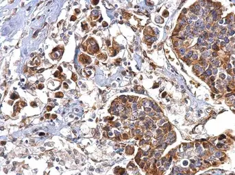 Anti-HSP47 antibody [N2C2], Internal used in IHC (Paraffin sections) (IHC-P). GTX103011