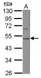 Anti-HSP47 antibody [N2C2], Internal used in Western Blot (WB). GTX103011