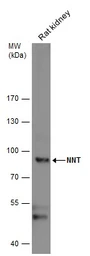 Anti-NNT antibody used in Western Blot (WB). GTX103015