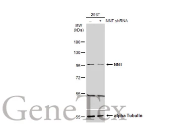 Anti-NNT antibody used in Western Blot (WB). GTX103015