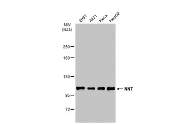 Anti-NNT antibody used in Western Blot (WB). GTX103015