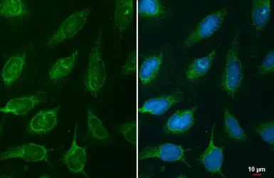 Anti-NNT antibody used in Immunocytochemistry/ Immunofluorescence (ICC/IF). GTX103015