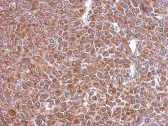 Anti-STIP1 antibody used in IHC (Paraffin sections) (IHC-P). GTX103019