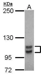 Anti-SP1 antibody used in Western Blot (WB). GTX103031