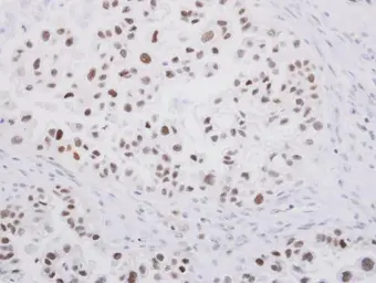 Anti-SP1 antibody used in IHC (Paraffin sections) (IHC-P). GTX103031