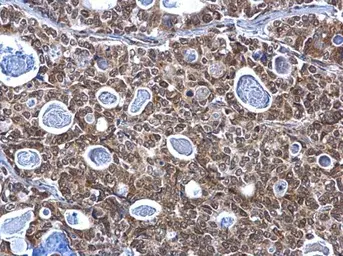 Anti-SP1 antibody used in IHC (Paraffin sections) (IHC-P). GTX103031