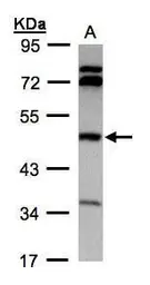 Anti-BHMT antibody used in Western Blot (WB). GTX103037