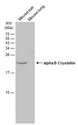 Anti-alpha B Crystallin antibody [N1C3] used in Western Blot (WB). GTX103053