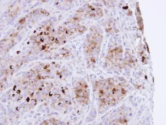 Anti-CRHSP-24 antibody [N1C3] used in IHC (Paraffin sections) (IHC-P). GTX103061