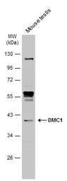 Anti-DMC1 antibody [N1C1] used in Western Blot (WB). GTX103062
