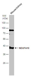 Anti-NDUFA10 antibody [N1C3] used in Western Blot (WB). GTX103093