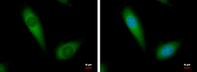 Anti-NDUFA10 antibody [N1C3] used in Immunocytochemistry/ Immunofluorescence (ICC/IF). GTX103093