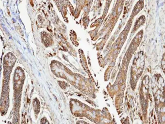 Anti-NDUFA10 antibody [N1C3] used in IHC (Paraffin sections) (IHC-P). GTX103093