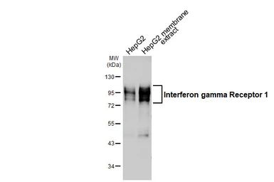 Anti-Interferon gamma Receptor 1 antibody used in Western Blot (WB). GTX103098