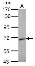 Anti-STXBP2 antibody [N2C1], Internal used in Western Blot (WB). GTX103111