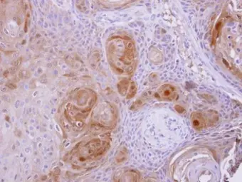 Anti-BBOX1 antibody used in IHC (Paraffin sections) (IHC-P). GTX103127