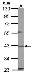Anti-BBOX1 antibody used in Western Blot (WB). GTX103127