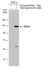 Anti-MDA5 antibody [N2C1], Internal used in Western Blot (WB). GTX103138