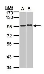 Anti-IL12 Receptor beta2 antibody [N3C2], Internal used in Western Blot (WB). GTX103166
