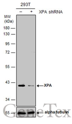 Anti-XPA antibody used in Western Blot (WB). GTX103168