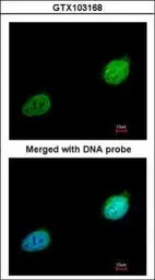 Anti-XPA antibody used in Immunocytochemistry/ Immunofluorescence (ICC/IF). GTX103168