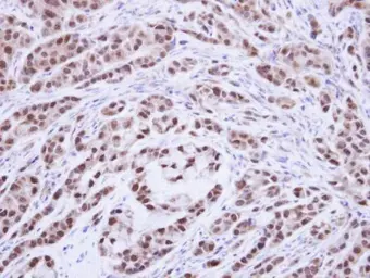 Anti-XPA antibody used in IHC (Paraffin sections) (IHC-P). GTX103168