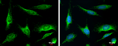 Anti-MUTYH antibody [N3C3] used in Immunocytochemistry/ Immunofluorescence (ICC/IF). GTX103185