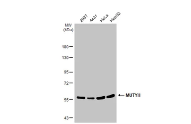 Anti-MUTYH antibody [N3C3] used in Western Blot (WB). GTX103185