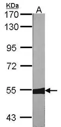 Anti-MUTYH antibody [N3C3] used in Western Blot (WB). GTX103185