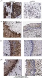 Anti-RRM2 antibody [N1C1] used in IHC (Paraffin sections) (IHC-P). GTX103193
