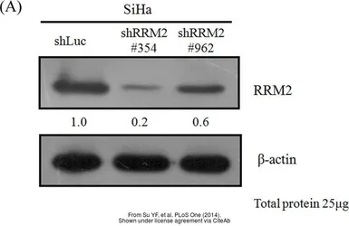 Anti-RRM2 antibody [N1C1] used in Western Blot (WB). GTX103193