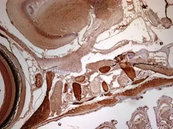 Anti-RRM2 antibody [N1C1] used in IHC (Paraffin sections) (IHC-P). GTX103193