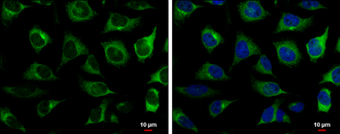 Anti-RRM2 antibody [N1C1] used in Immunocytochemistry/ Immunofluorescence (ICC/IF). GTX103193