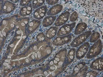 Anti-RRM2 antibody [N1C1] used in IHC (Paraffin sections) (IHC-P). GTX103193
