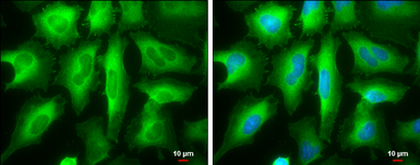 Anti-RRM2 antibody [N1C1] used in Immunocytochemistry/ Immunofluorescence (ICC/IF). GTX103193