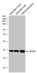 Anti-RRM2 antibody [N1C1] used in Western Blot (WB). GTX103193