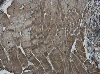 Anti-RRM2 antibody [N1C1] used in IHC (Paraffin sections) (IHC-P). GTX103193