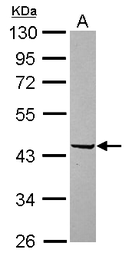 Anti-PAI2 antibody used in Western Blot (WB). GTX103194