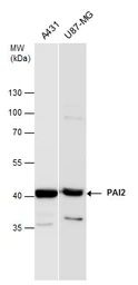 Anti-PAI2 antibody used in Western Blot (WB). GTX103194