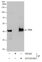 Anti-PAI2 antibody used in Immunoprecipitation (IP). GTX103194