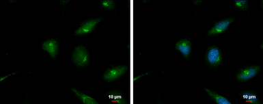Anti-PAI2 antibody used in Immunocytochemistry/ Immunofluorescence (ICC/IF). GTX103194